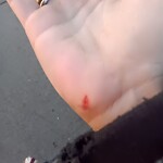 Unshoveled/Icy Sidewalk at 60 High St